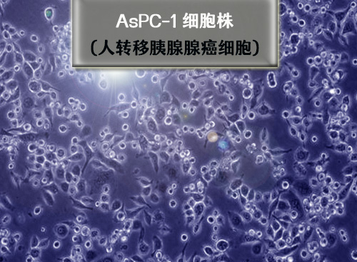 AsPc-1細(xì)胞-人轉(zhuǎn)移胰腺腺癌細(xì)胞?