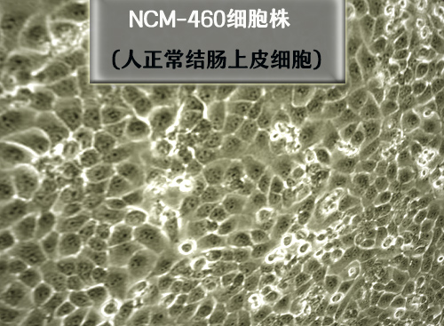 NCM460細(xì)胞