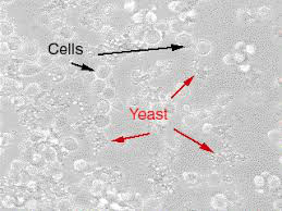酵母污染6