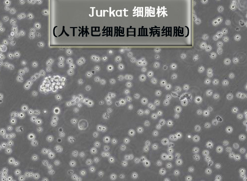 Jurkat細胞?