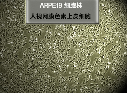 人視網(wǎng)膜色素上皮細(xì)胞 ARPE19