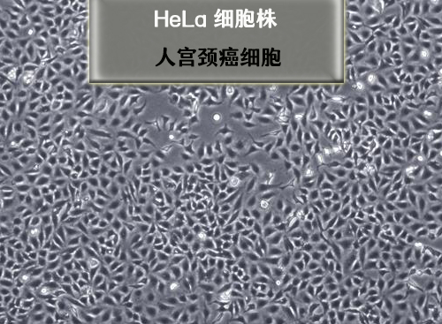 人宮頸癌細(xì)胞-HeLa?細(xì)胞