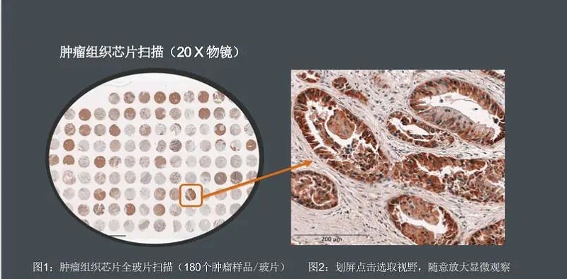 組織切片