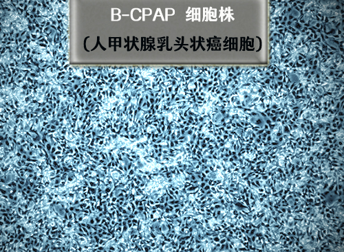 B-CPAP細(xì)胞