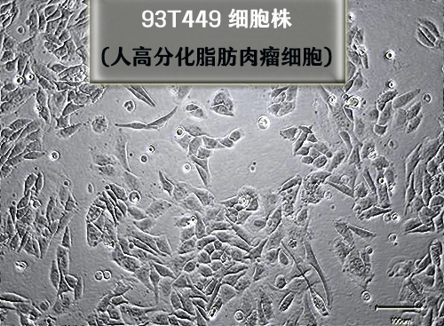 93T449細(xì)胞-人高分化脂肪肉瘤細(xì)胞?