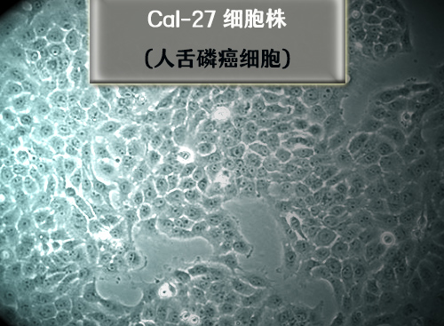 Cal-27細(xì)胞